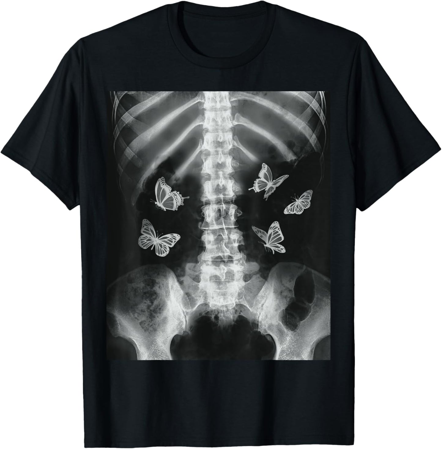 Egirl Skeleton Xray Butterfly Harajuku Y2K Dark Edgy Grunge T-Shirt